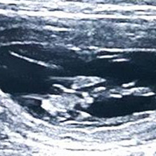 Jodie is in pups - ultrasound